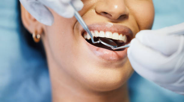 Best Knocked-Out Tooth Emergency  in Centennial, CO